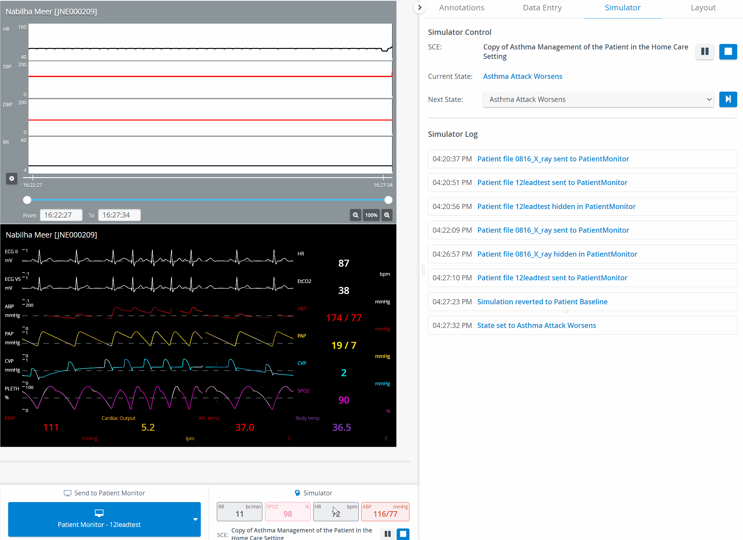 Send to Screen - Patient Monitor (with Simulator Log)