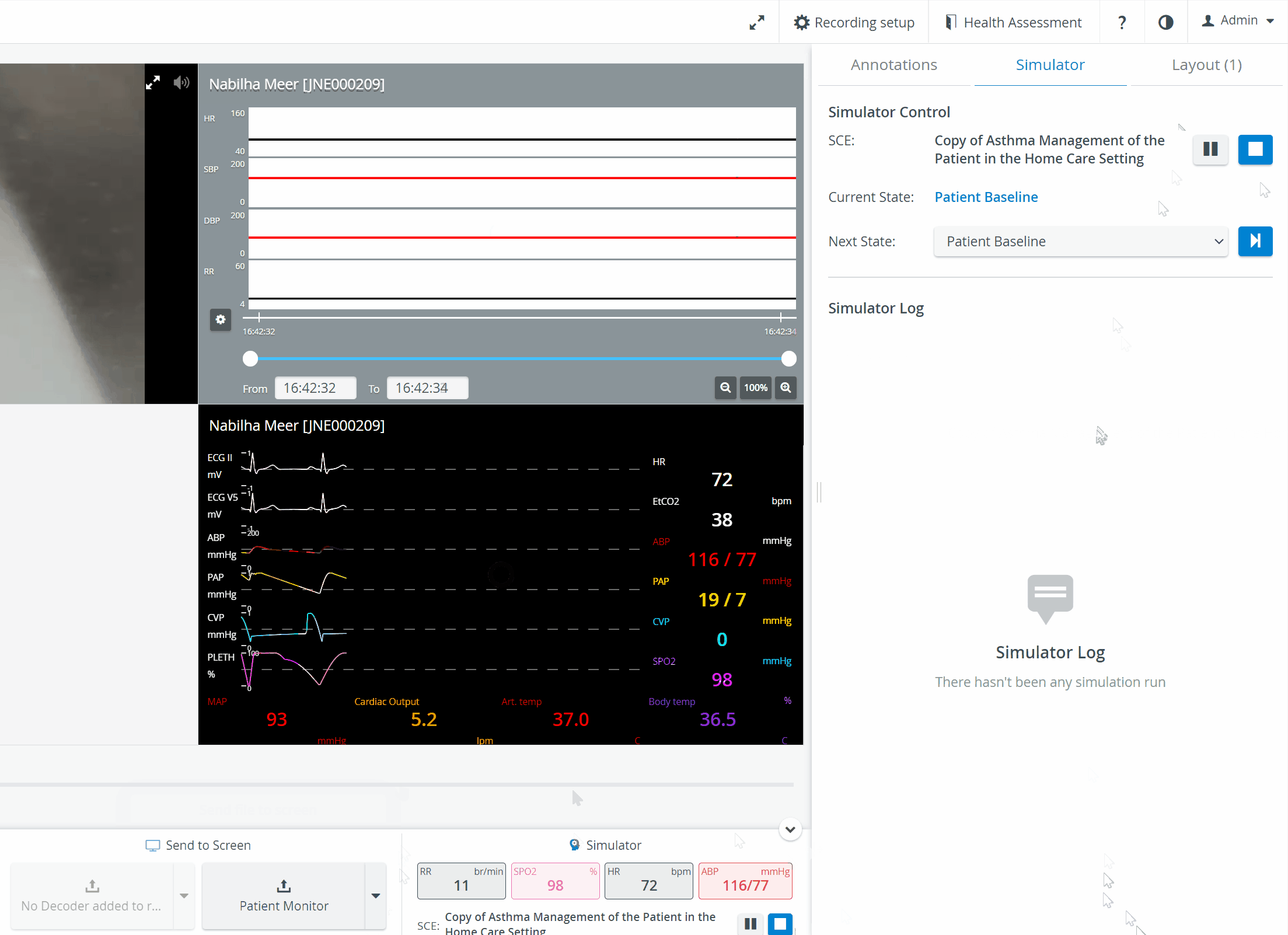 Send to Screen - Patient monitor (with Simulator log)